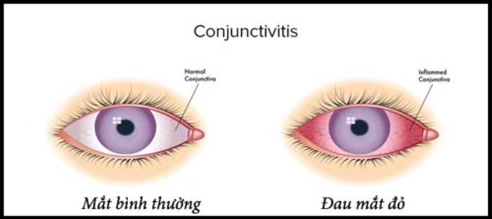 Sở Giáo Dục Và Đào Tạo Vĩnh Phúc